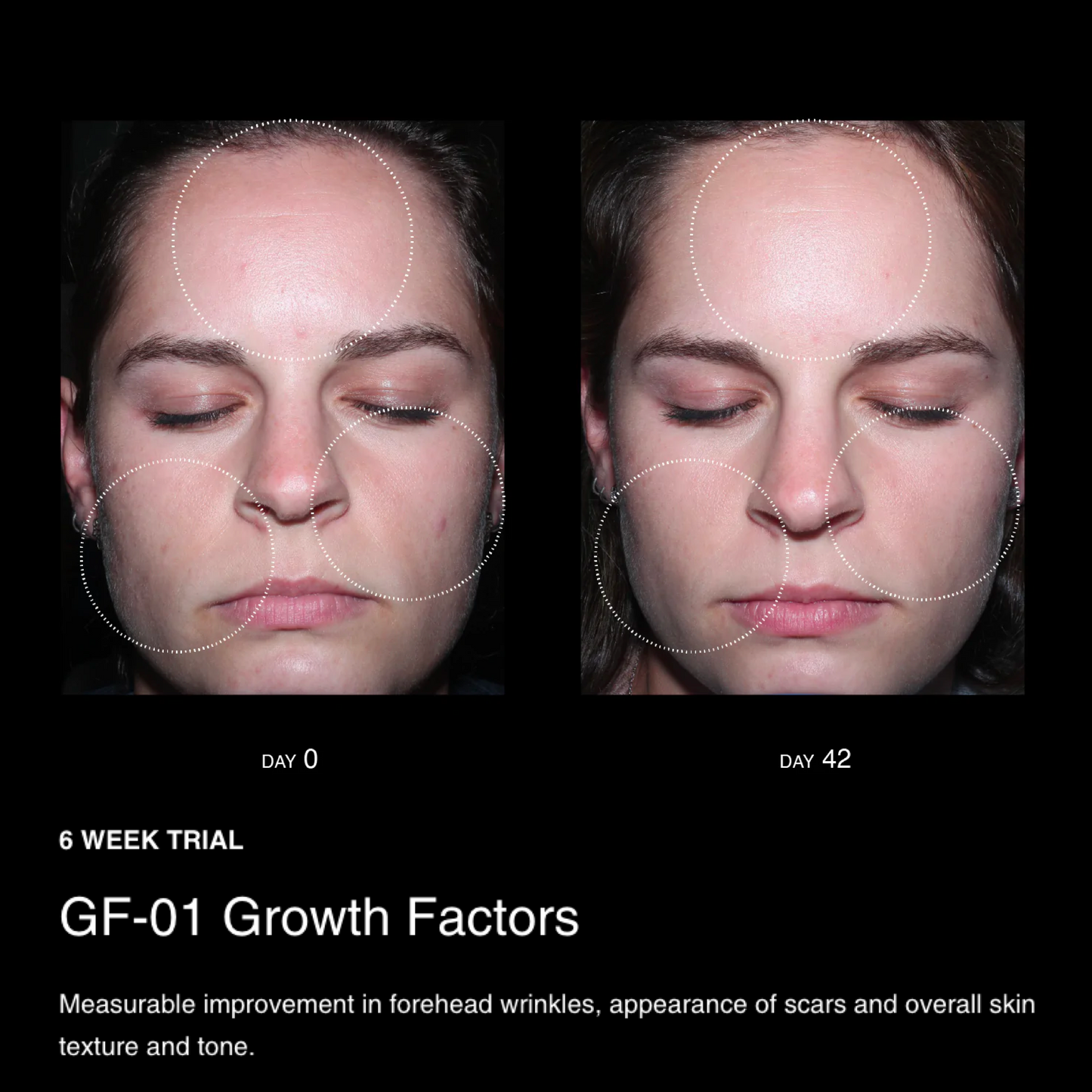 BioActive Growth Factors Set: curated by Master Esthetician Penn Smith